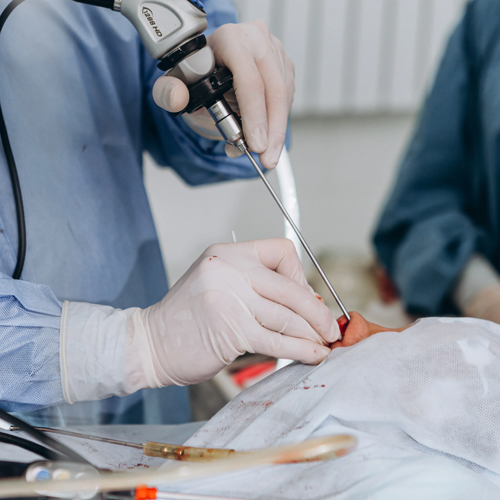 Gastro Surgeon