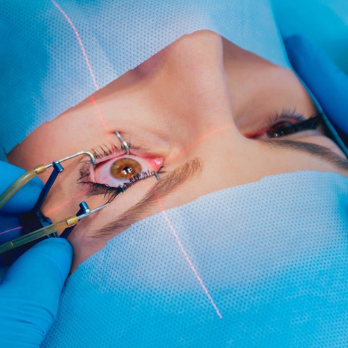 Eye Specialist